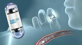 کپسول اندوسکوپی